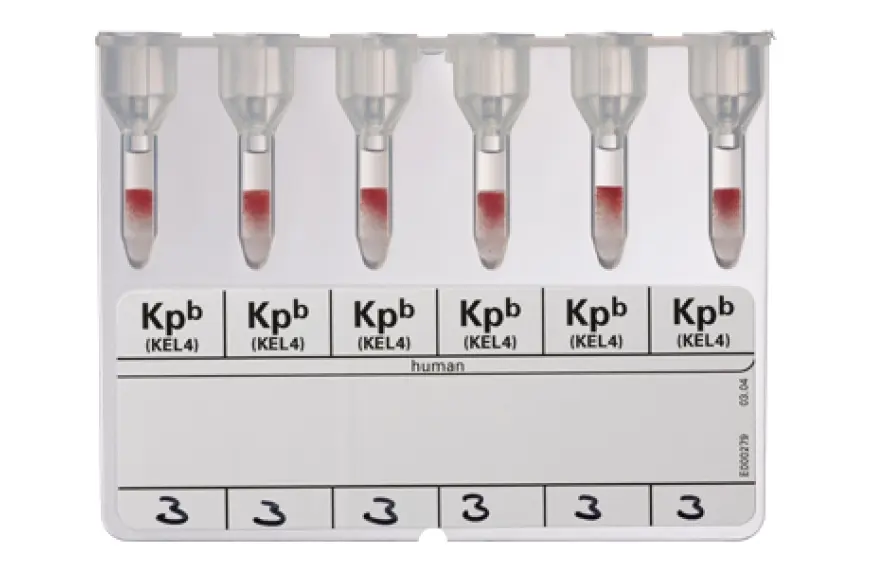 ihd_anti_kpb_pdp