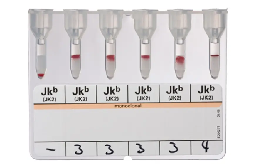 ihd_diaclon_anti_jkb_pdp