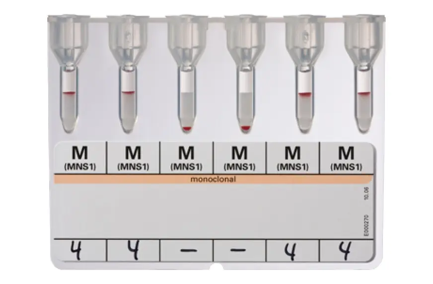 ihd_diaclon_anti_m1_pdp