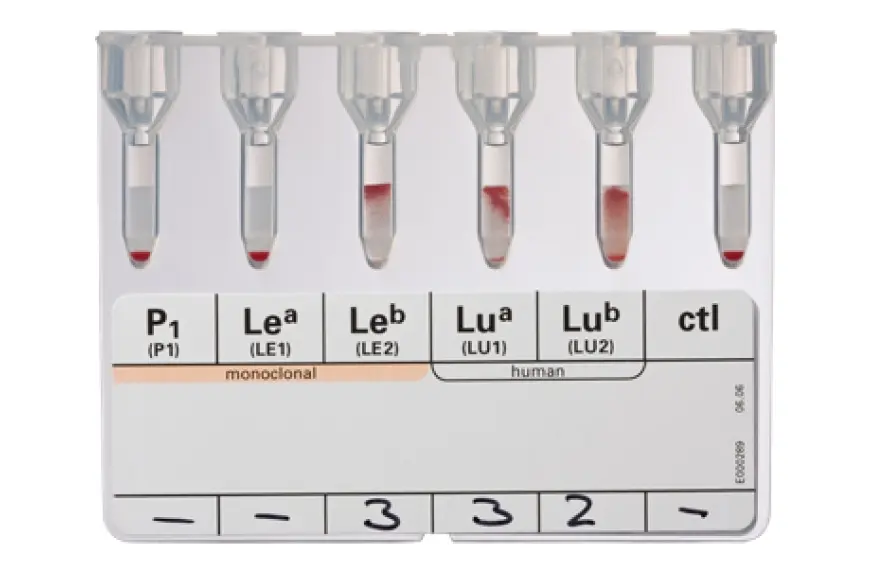 ihd_id_antigen_profile_i_pdp